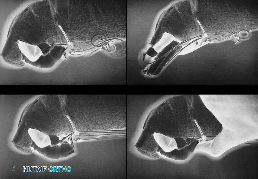 Hutaifortho's Orthopaedic Diagram
