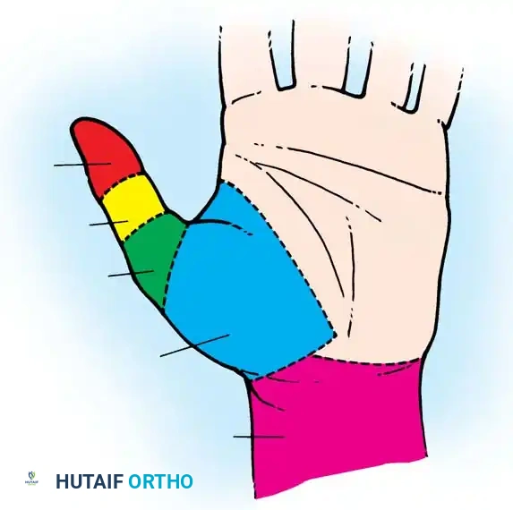 Hutaifortho's Orthopaedic Diagram