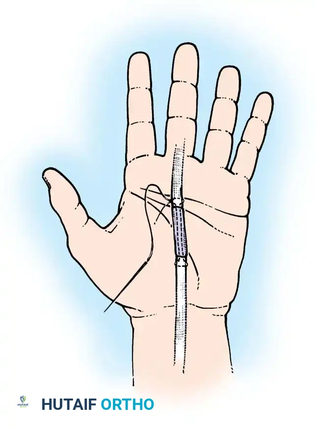 Hutaifortho's Orthopaedic Diagram