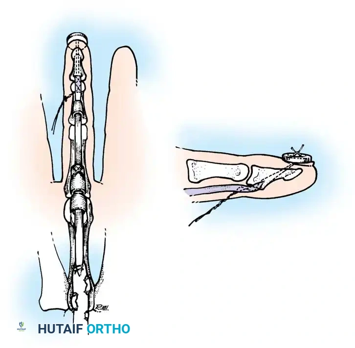 Hutaifortho's Orthopaedic Diagram