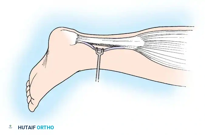 Hutaifortho's Orthopaedic Diagram