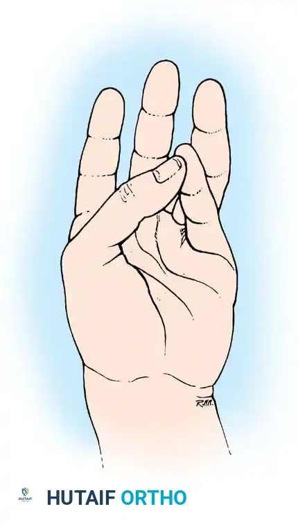 Hutaifortho's Orthopaedic Diagram