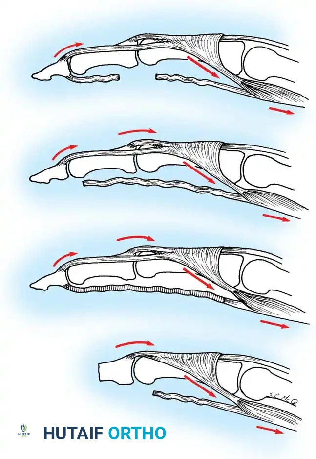 Hutaifortho's Orthopaedic Diagram
