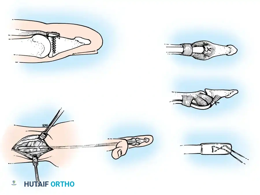 Hutaifortho's Orthopaedic Diagram