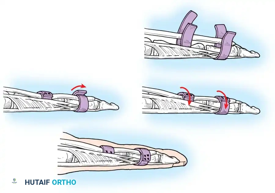 Hutaifortho's Orthopaedic Diagram