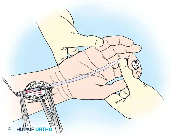 Hutaifortho's Orthopaedic Diagram