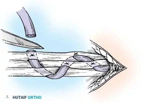 Hutaifortho's Orthopaedic Diagram