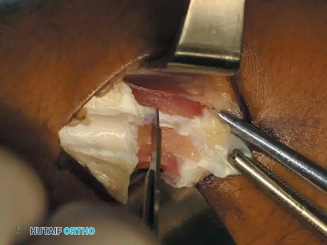 Unlock Foot Movement: Note the Presence of Critical Anatomical Joints