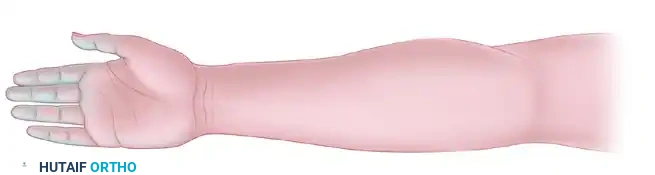 Forearm Fasciotomy and Arterial Exploration: A Comprehensive Surgical Guide