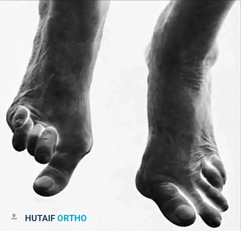 Hutaifortho's Orthopaedic Diagram