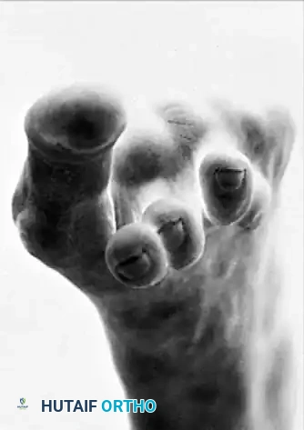 Hutaifortho's Orthopaedic Diagram