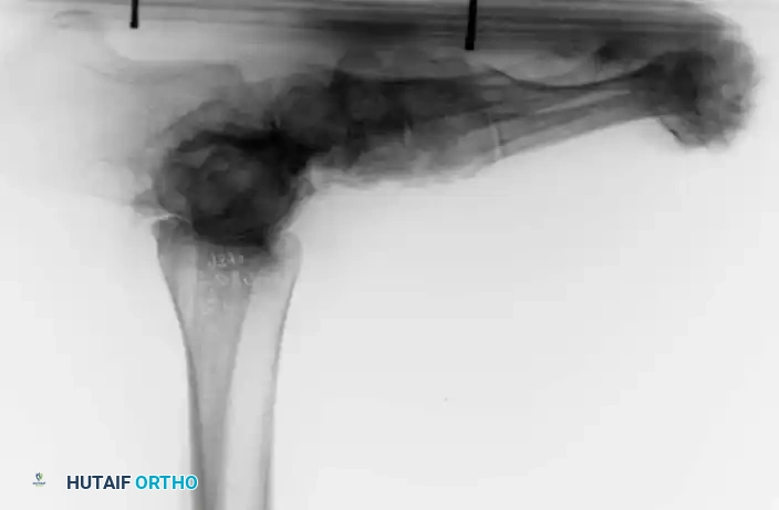 Hutaifortho's Orthopaedic Diagram