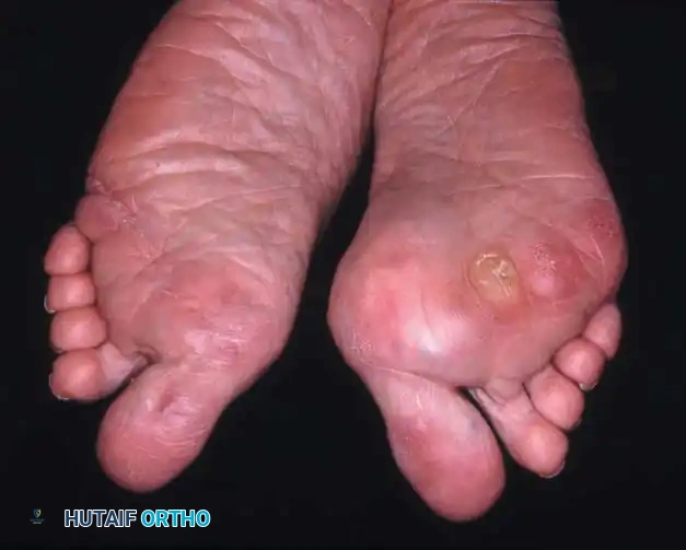 Hutaifortho's Orthopaedic Diagram