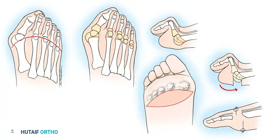 Hutaifortho's Orthopaedic Diagram