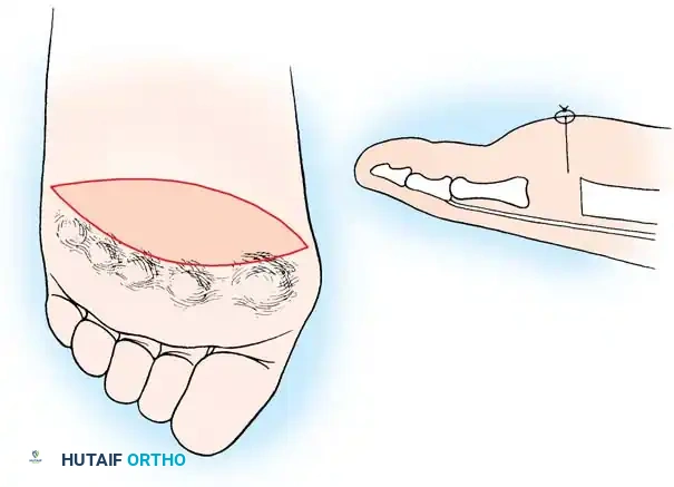 Hutaifortho's Orthopaedic Diagram