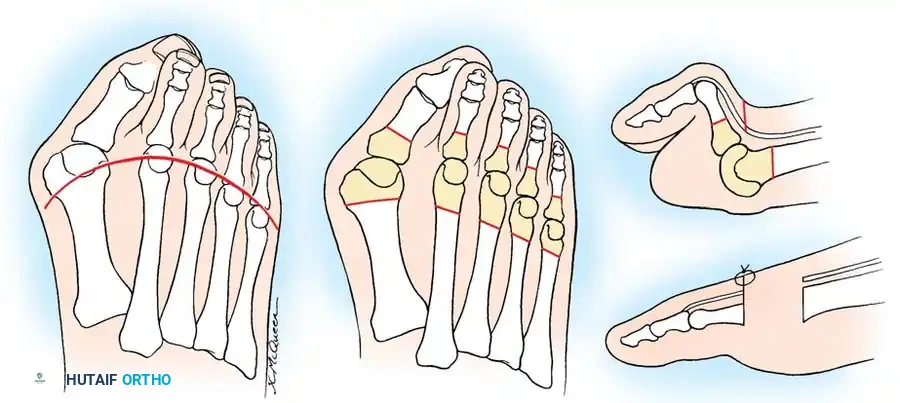 Hutaifortho's Orthopaedic Diagram