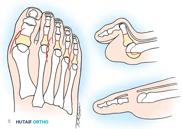 Hutaifortho's Orthopaedic Diagram