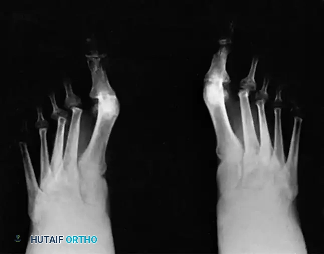 Hutaifortho's Orthopaedic Diagram