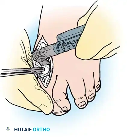 Hutaifortho's Orthopaedic Diagram
