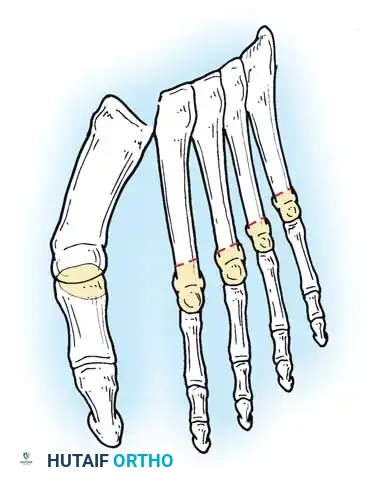 Hutaifortho's Orthopaedic Diagram
