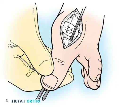 Hutaifortho's Orthopaedic Diagram