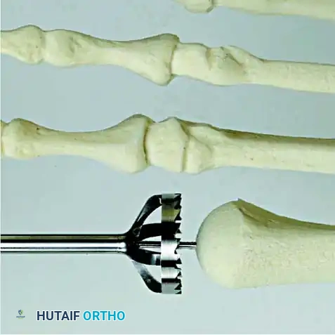 Hutaifortho's Orthopaedic Diagram