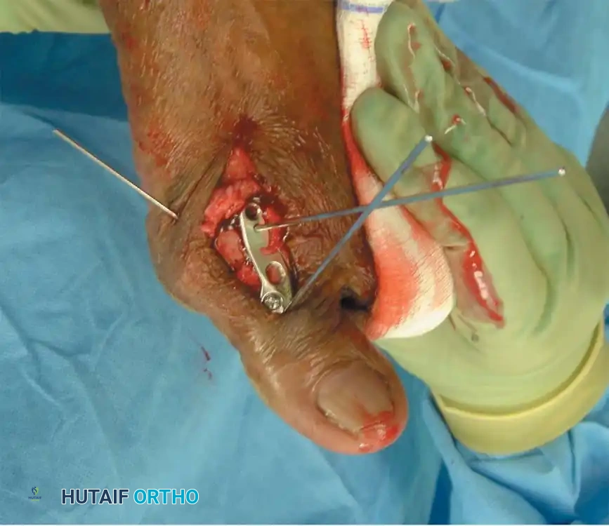 Hutaifortho's Orthopaedic Diagram