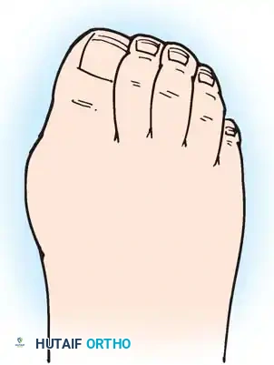 Hutaifortho's Orthopaedic Diagram