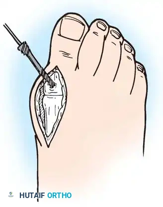 Hutaifortho's Orthopaedic Diagram