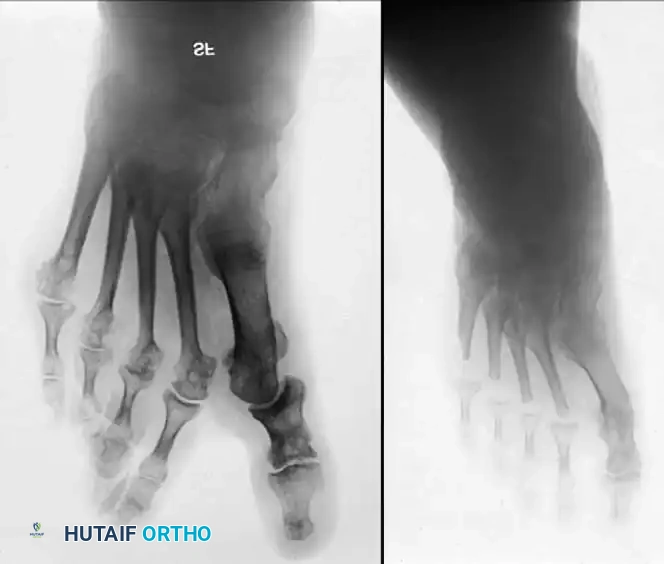 Hutaifortho's Orthopaedic Diagram