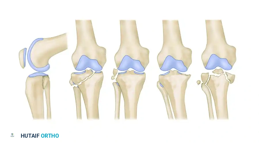 Hohl and Moore Classification Diagram