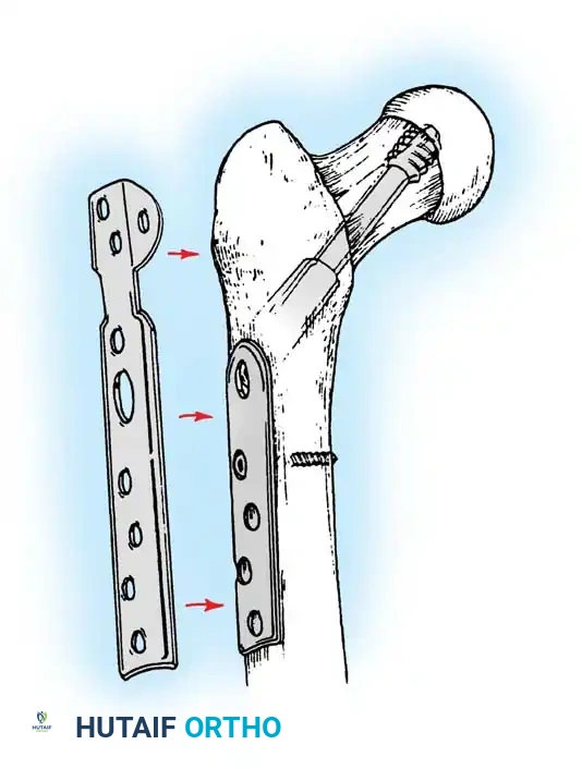 Hutaifortho's Orthopaedic Diagram