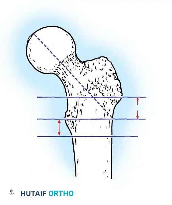 Hutaifortho's Orthopaedic Diagram