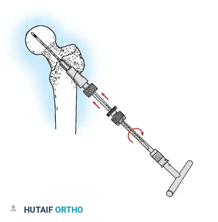 Hutaifortho's Orthopaedic Diagram