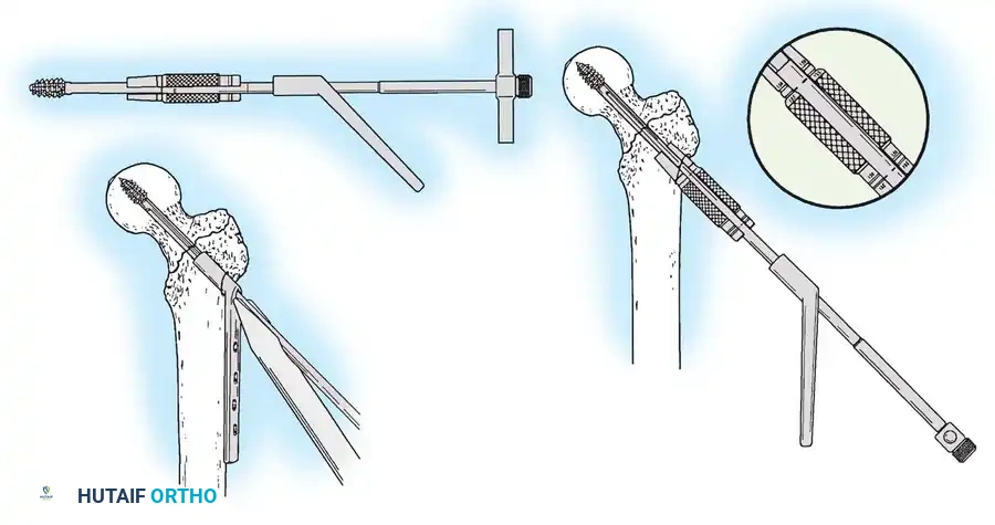 Hutaifortho's Orthopaedic Diagram