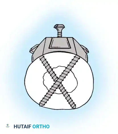 Hutaifortho's Orthopaedic Diagram