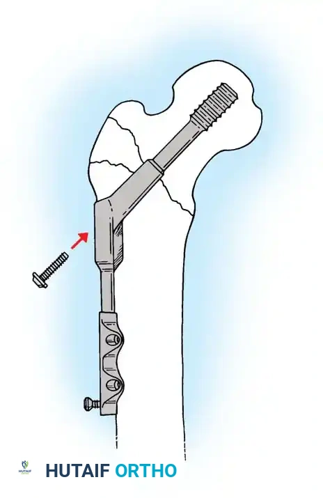 Hutaifortho's Orthopaedic Diagram