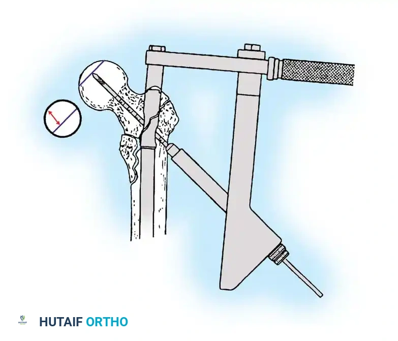 Hutaifortho's Orthopaedic Diagram
