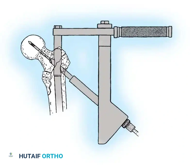 Hutaifortho's Orthopaedic Diagram
