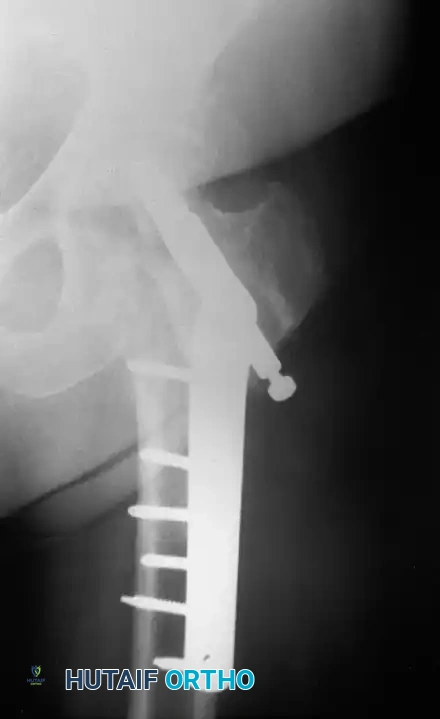 Hutaifortho's Orthopaedic Diagram