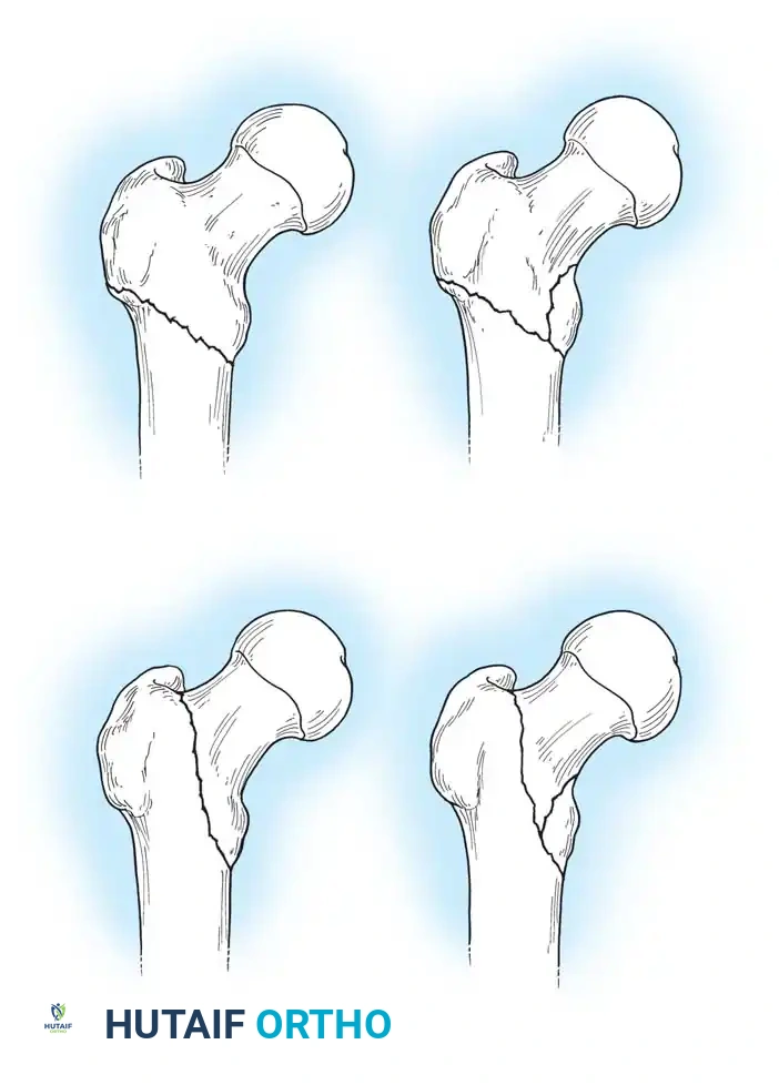 Hutaifortho's Orthopaedic Diagram