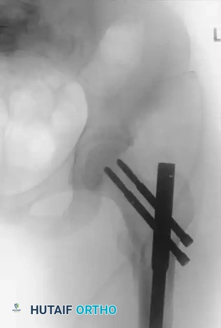 Hutaifortho's Orthopaedic Diagram