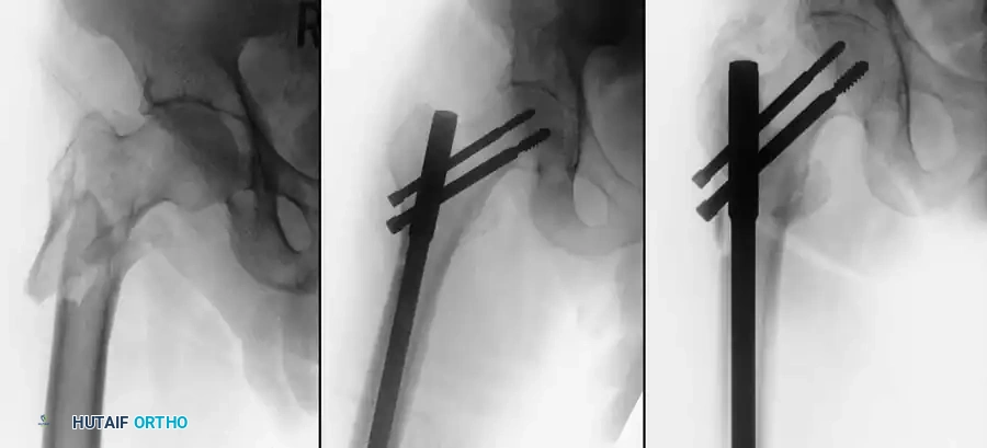 Hutaifortho's Orthopaedic Diagram