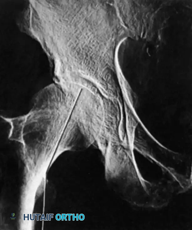 Hutaifortho's Orthopaedic Diagram