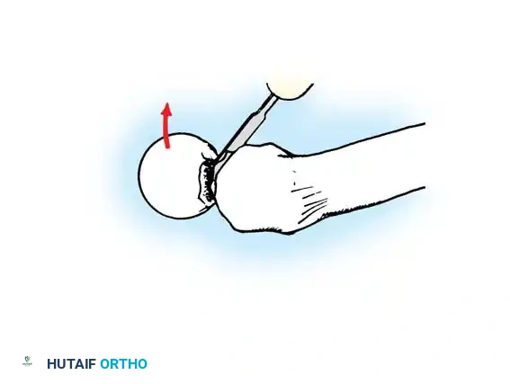 Hutaifortho's Orthopaedic Diagram