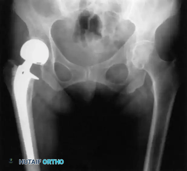 Hutaifortho's Orthopaedic Diagram
