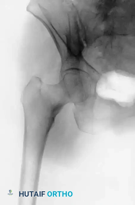 Hutaifortho's Orthopaedic Diagram