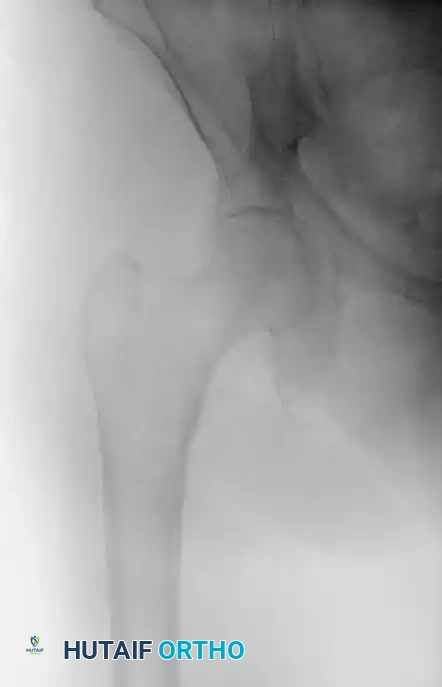 Hutaifortho's Orthopaedic Diagram