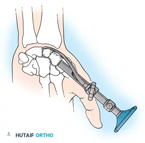 Hutaifortho's Orthopaedic Diagram