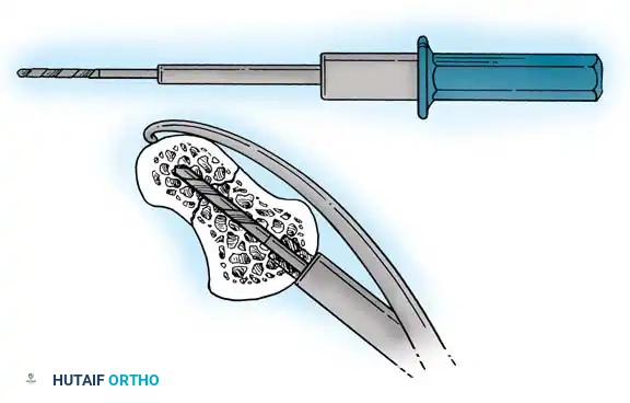 Hutaifortho's Orthopaedic Diagram